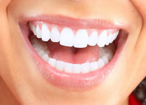 woman with healthy gum in golden coast