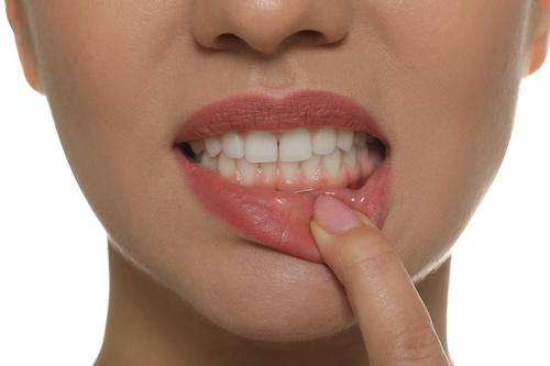 mouth profile for laser dentistry long beach ca