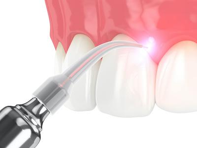 periodontist long beach ca