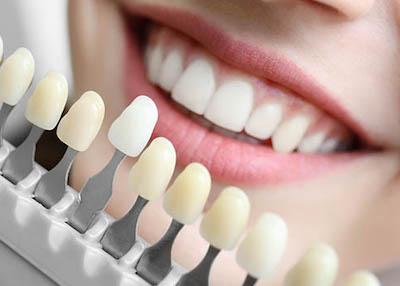 full set of white teeth | cosmetic dentistry long beach