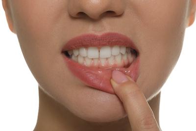 periodontal treatment long beach ca