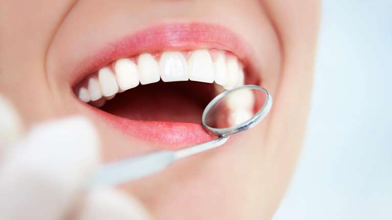 A smiling woman and a dental mirror
