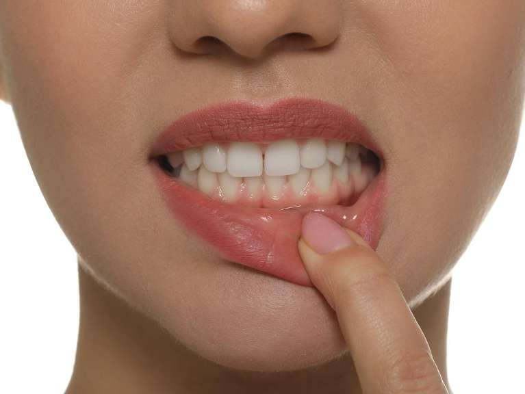 A woman pulling her lip down to show her teeth