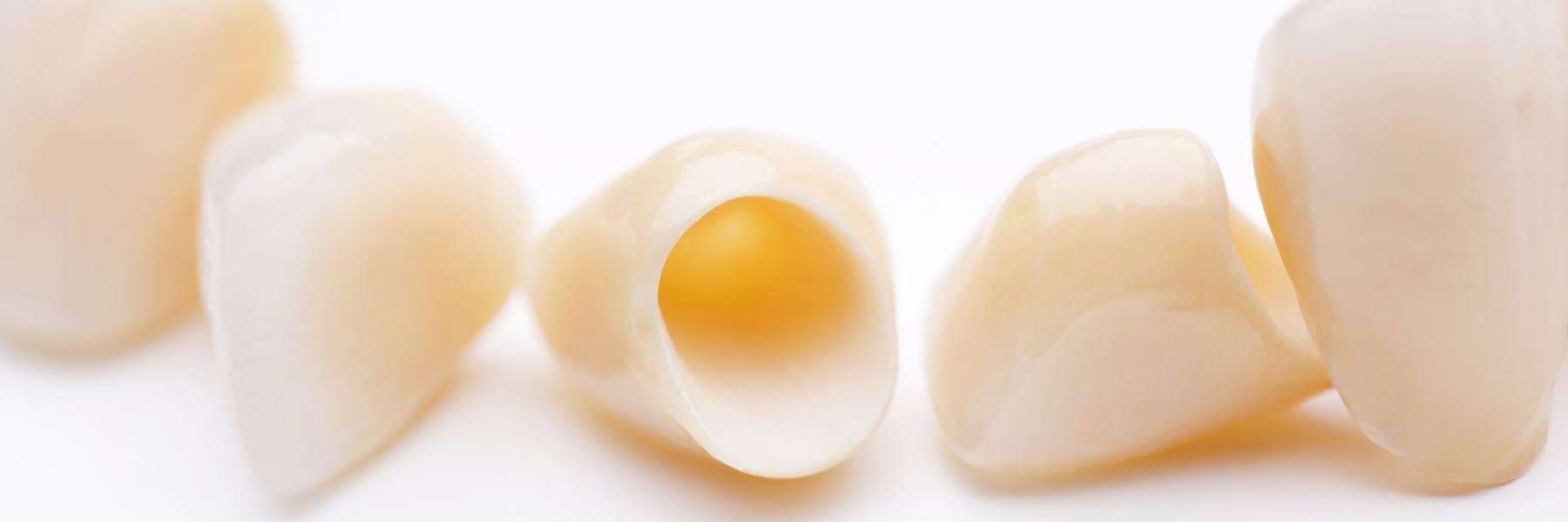 dental crown