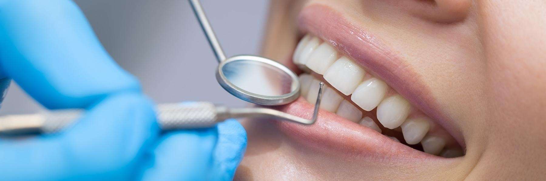 A smiling woman getting a dental exam in Long Beach