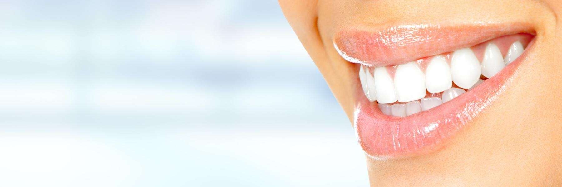 set of pearly white teeth | periodontist Long Beach