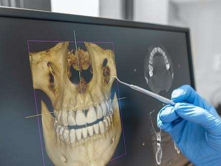 3D cone beam technology created image