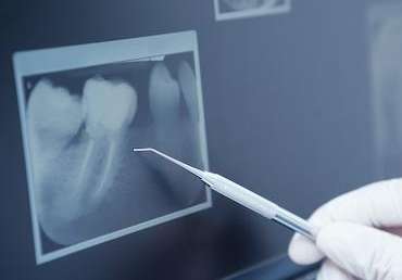 Image of a digital x-ray