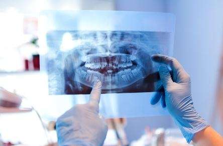 An image of a panoramic x-ray